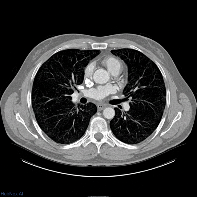 Chest CT scan - DICOM instant access