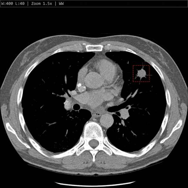 CT scan in DICOM reading view